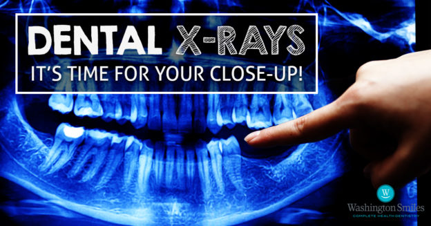 Dental X-Rays Article
