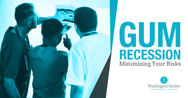 Gum Recession: Minimizing Your Risks