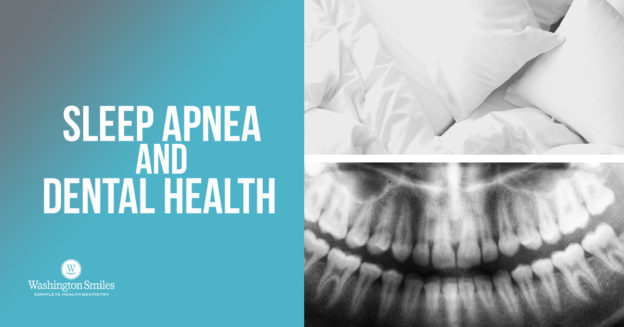 Sleep Apnea and Dental Health