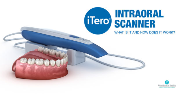 ITERO SCANNER — Valiente Dental