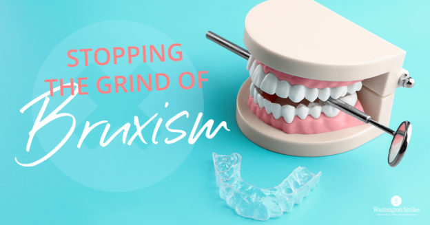 Stopping the Grind of Bruxism