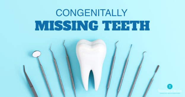 Congenitally Missing Teeth