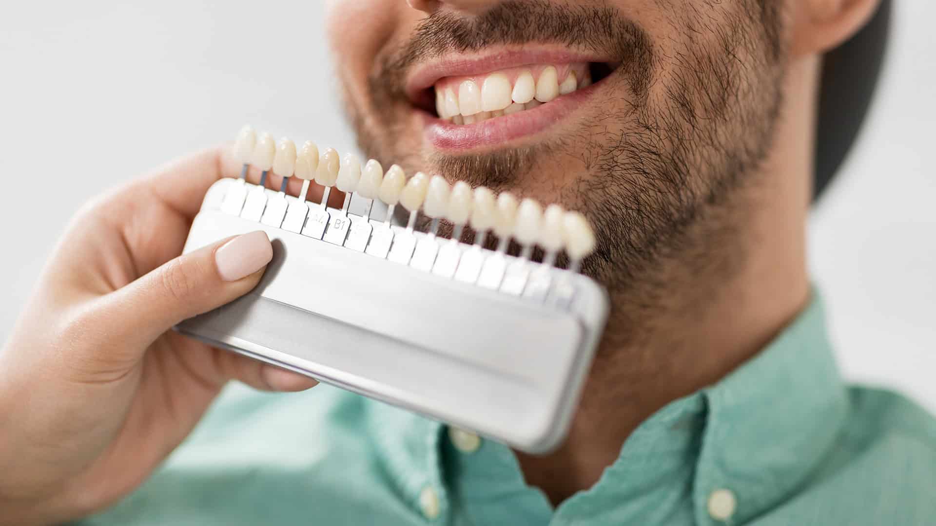 Dental Crown Color Spectrum