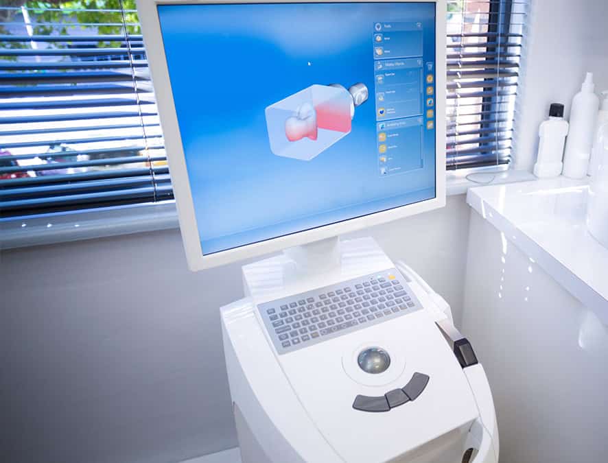 iTero Intraoral Scanner