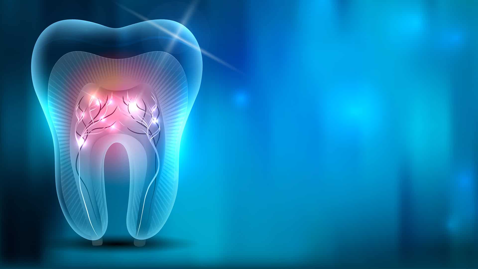 Root Canal Digital Image