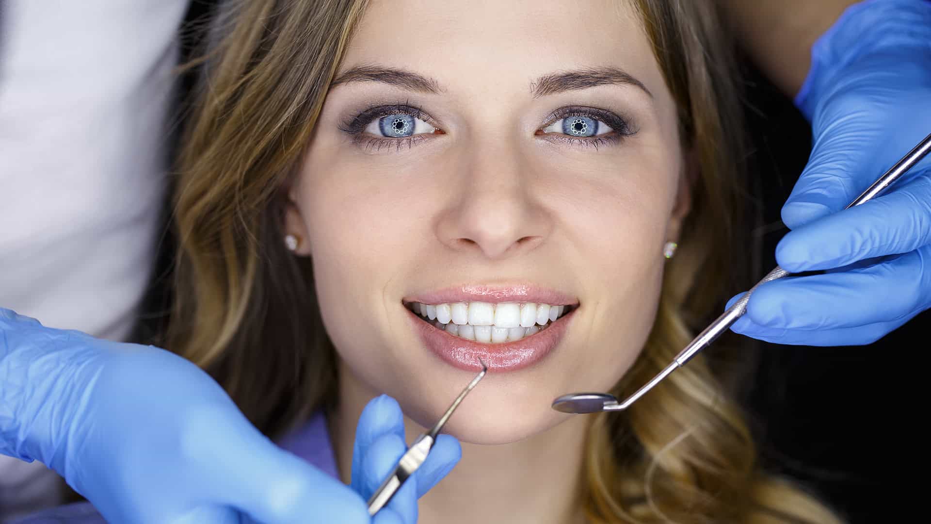 Woman Smiling After Veneers Procedure