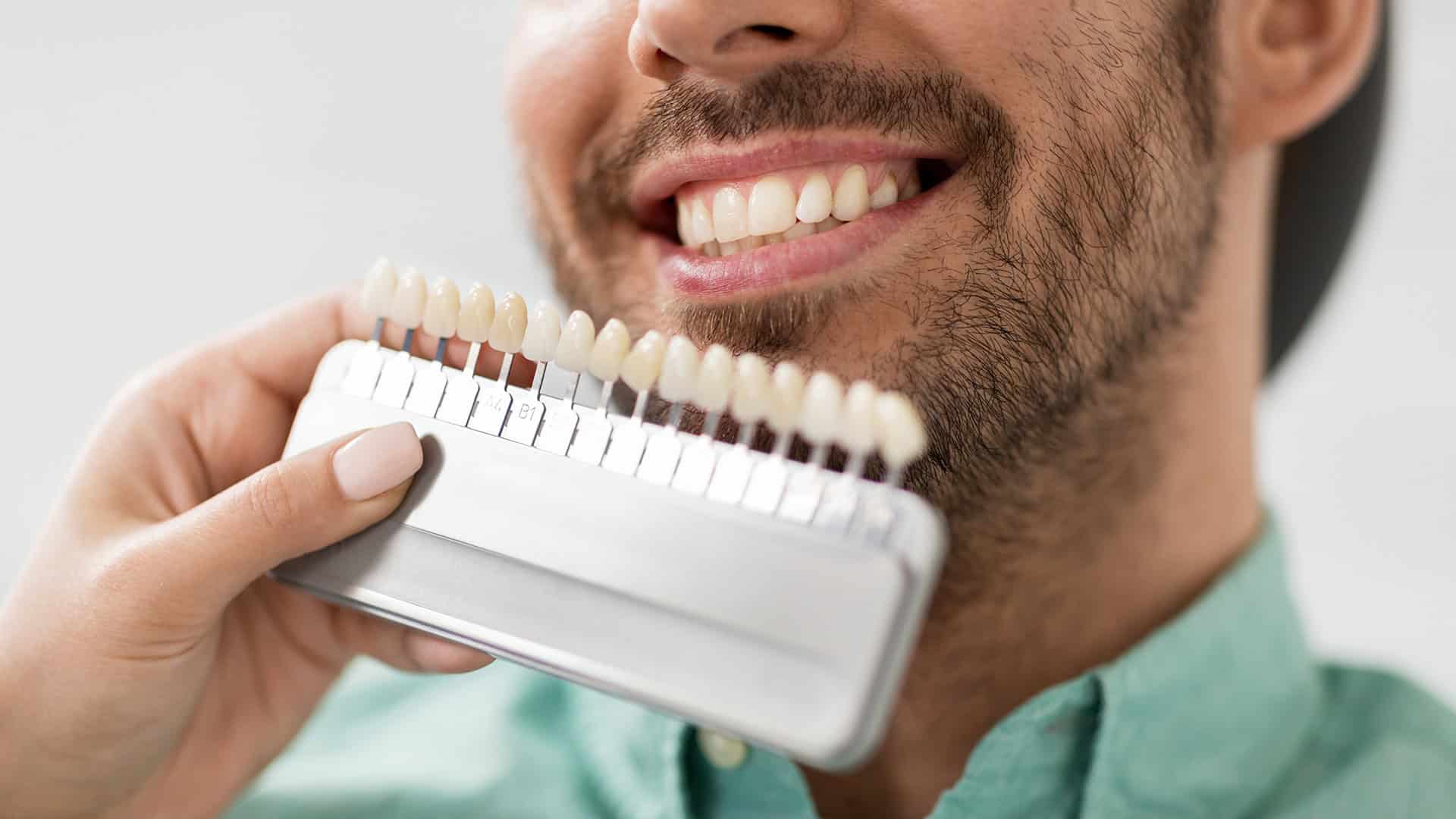 Teeth Whitening Color Spectrum